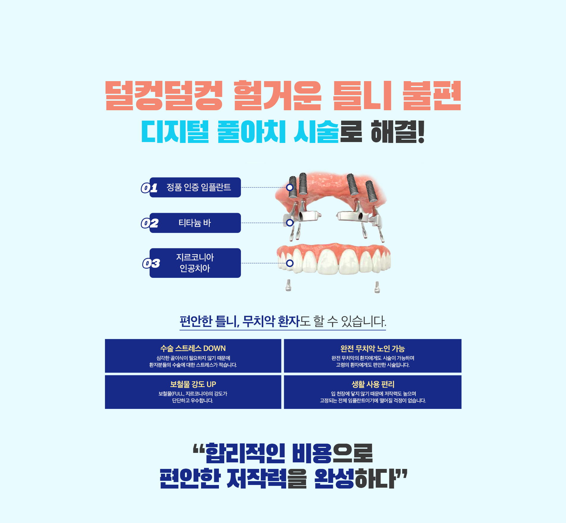 덜컹덜컹 헐거운 틀니 불편, 디지털 풀아치 시술