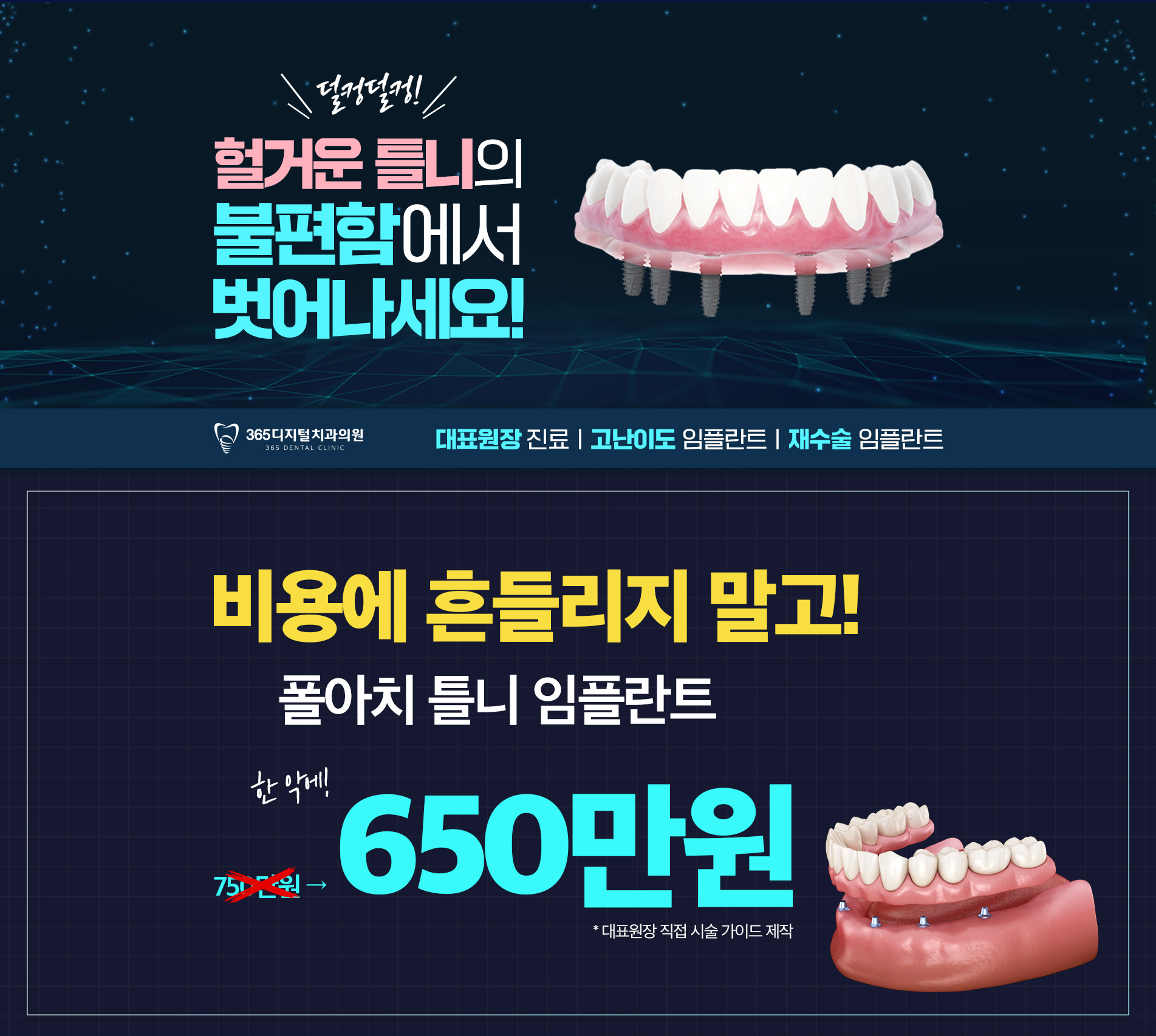 풀아치 틀니 임플란트