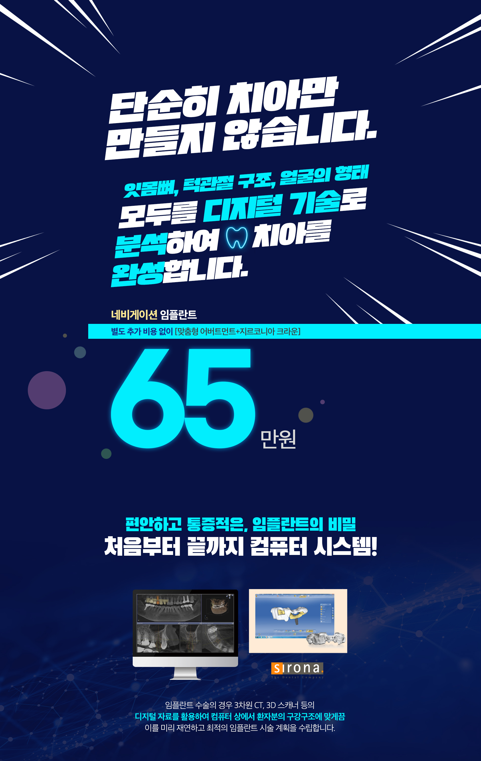 대전 풀아치 전체 임플란트