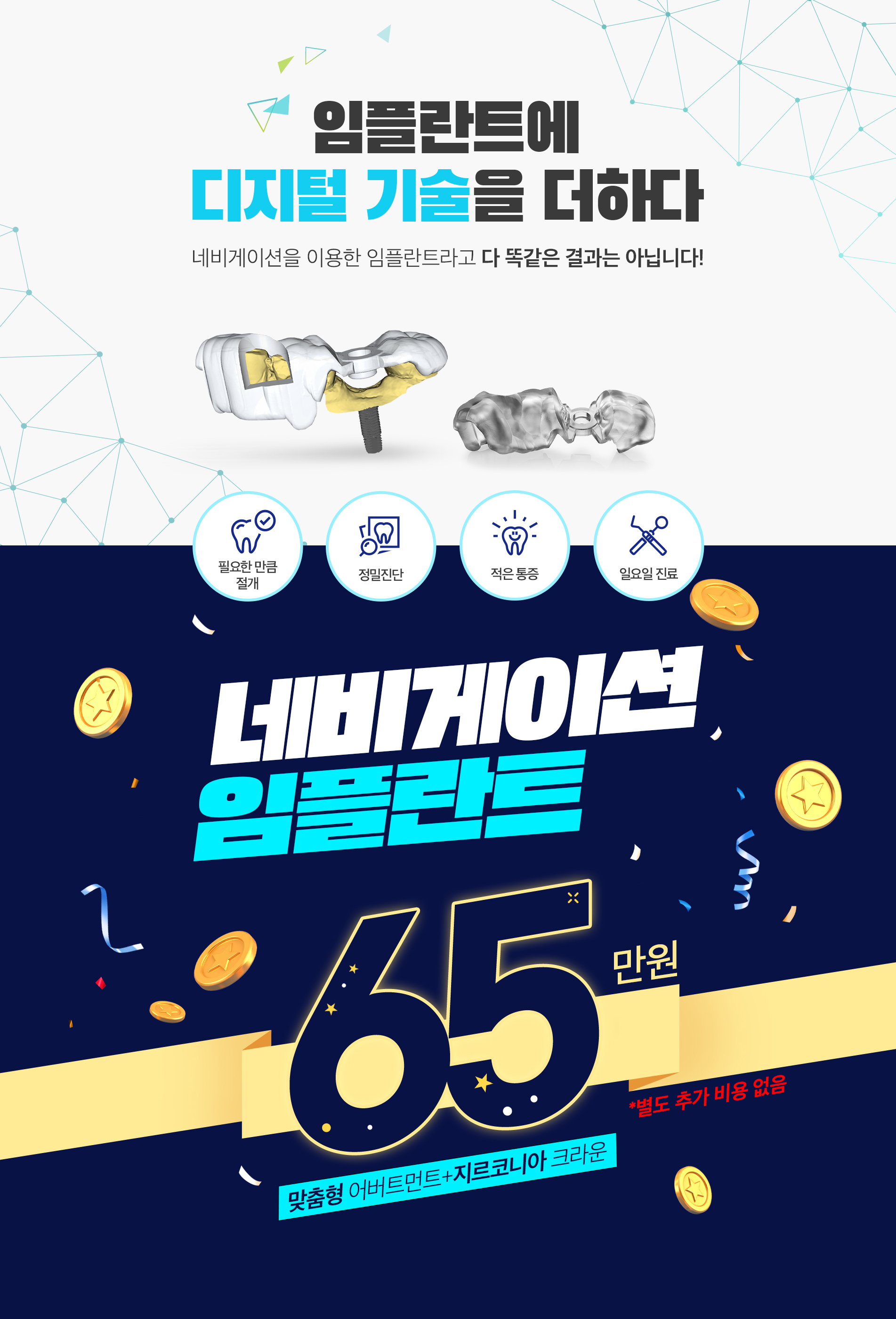 네비게이션 임플란트