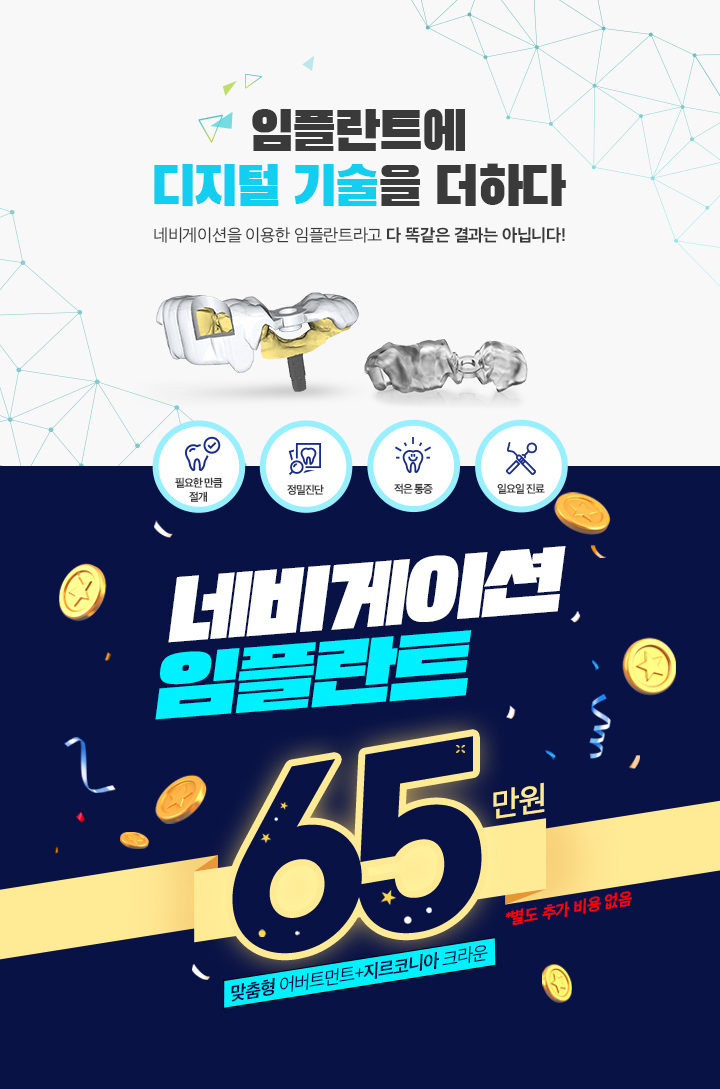 네비게이션 임플란트